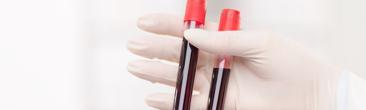 Haemoglobin: what a low haemoglobin level can mean for your health